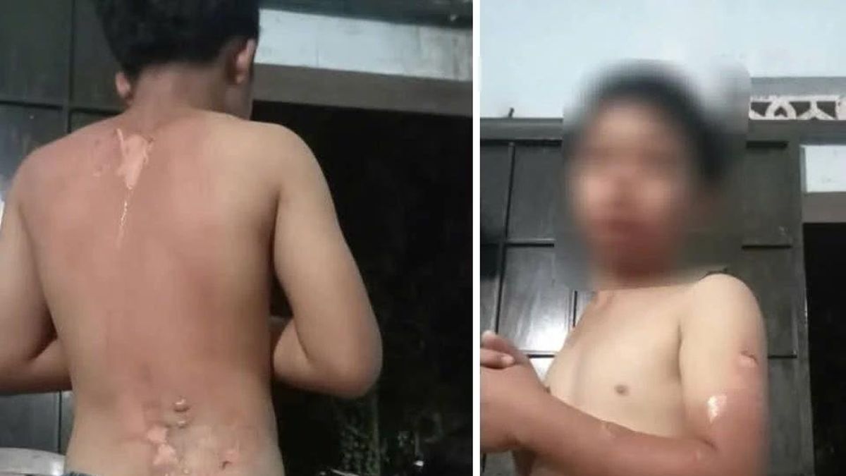 Đắk Lắk: Xác minh thông tin bé trai nghi bị mẹ tạt nước sôi gây bỏng nặng - Báo VietnamPlus