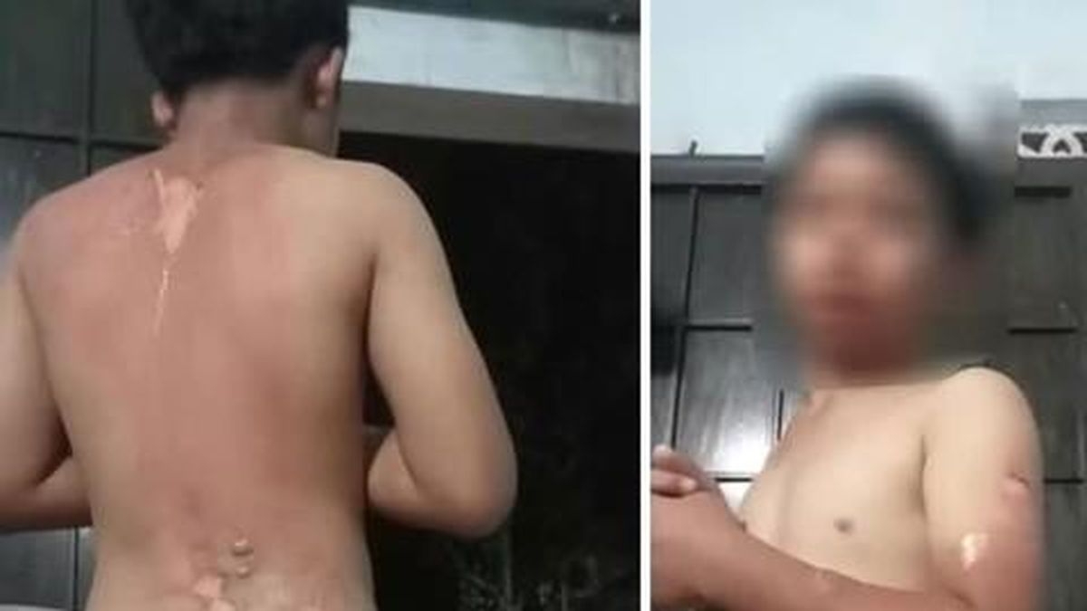 Đắk Lắk: Khẩn trương xác minh làm rõ thông tin bé trai nghi bị mẹ tạt nước sôi gây bỏng nặng - Công An TP.HCM