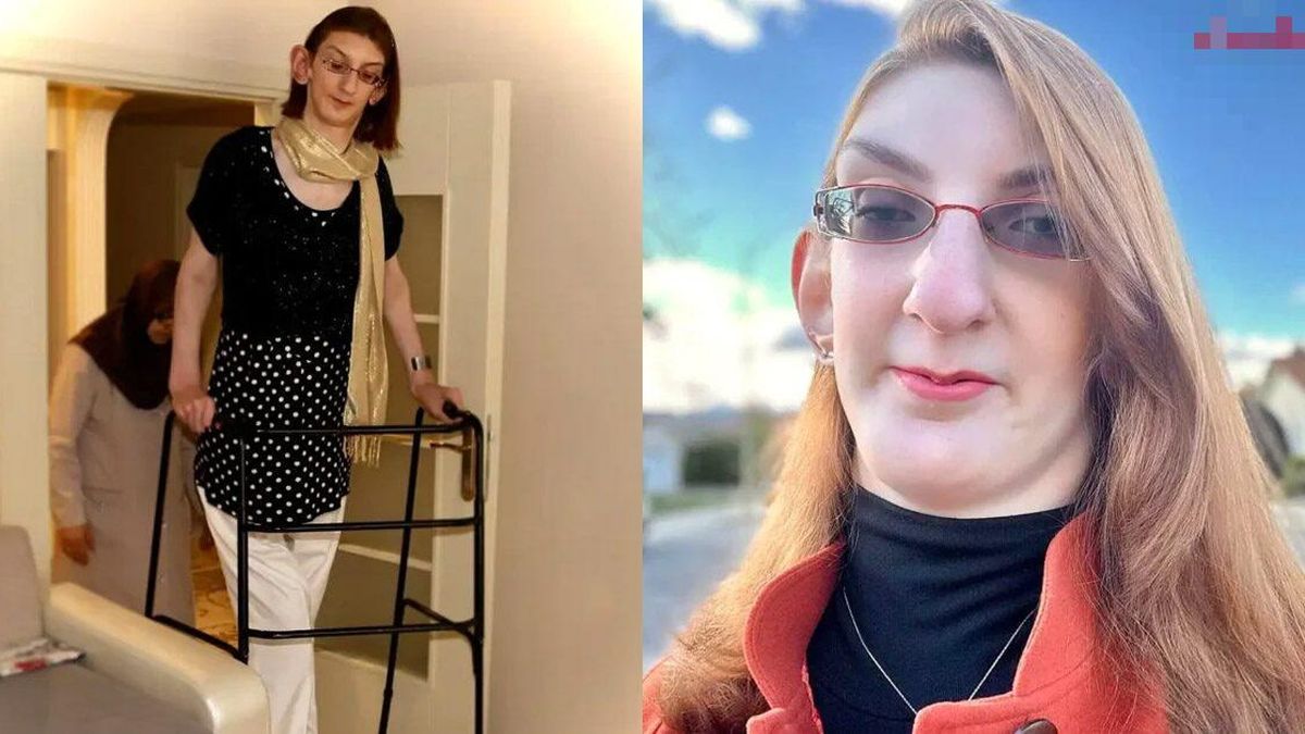 Женщина с рекордной высотой 2,13 м спустя 29 лет узнала истинную причину своего заболевания