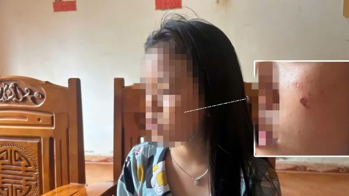 Nữ sinh lớp 10 ở Đắk Lắk lên tiếng về nguyên nhân bị bạn hành hung - Báo Giáo Dục & Thời Đại