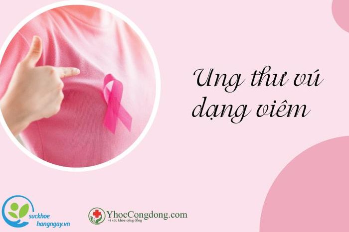ung-th-v-d-ng-vi-m-v-nh-ng-i-u-b-n-c-n-bi-t-b-o-ph-n-vi-t-nam